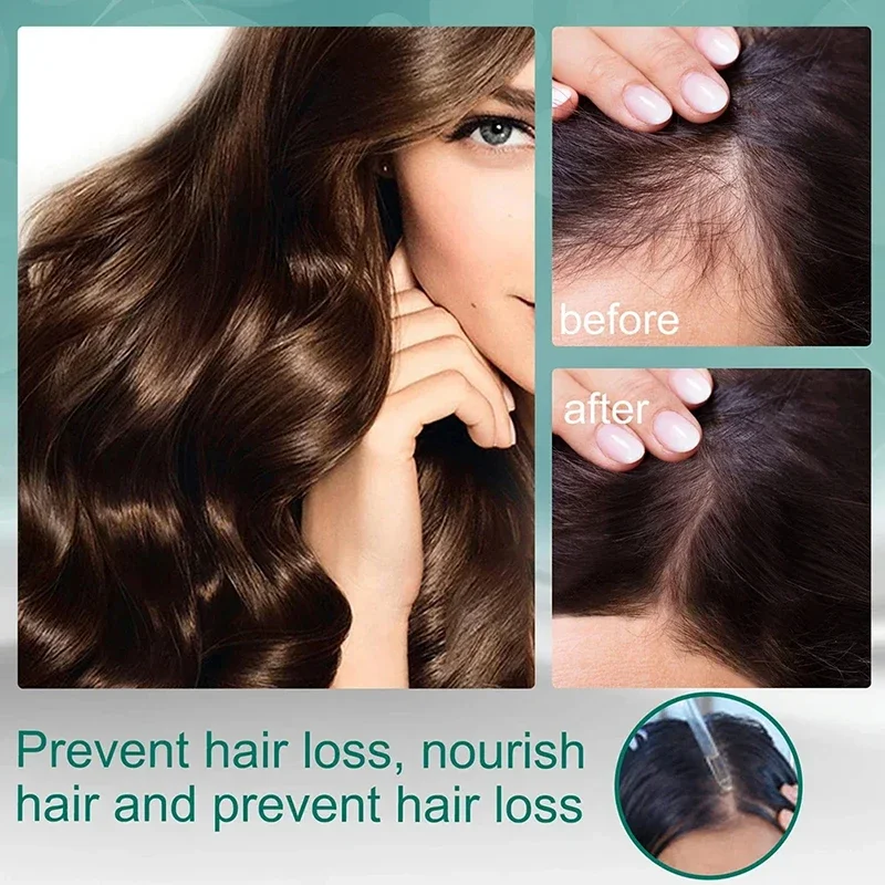 Treatment Liquid Four Herbs Na - Hair Care Natural Ingredients review and price
