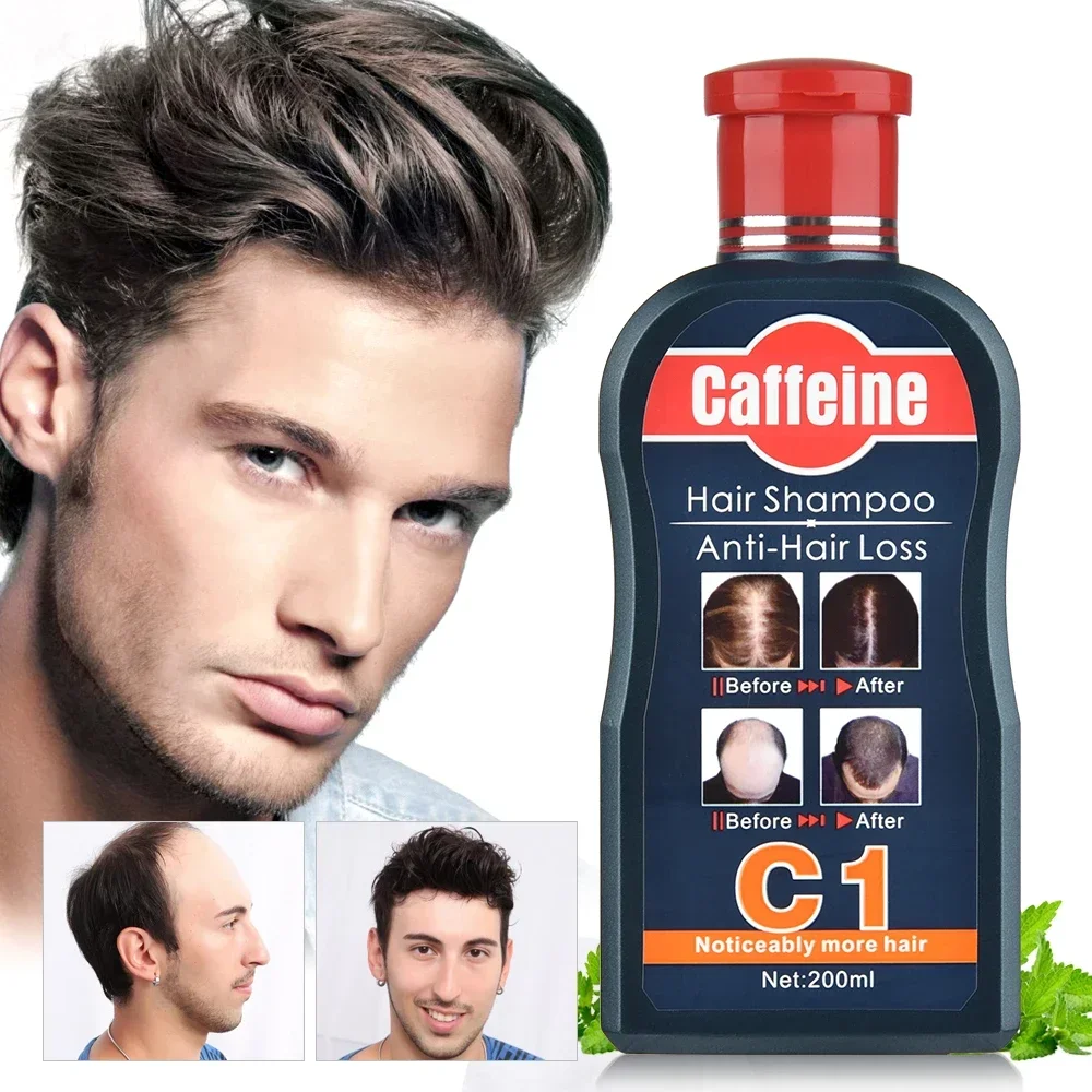Men Shampoo For Hair Growth Na - Hair Care Korean Products review and price